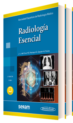 Radiología Esencial SERAM