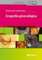 Ecografía ginecológica - Gori