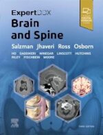 ExpertDDx Brain and Spine