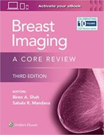Breast Imaging A Core Review