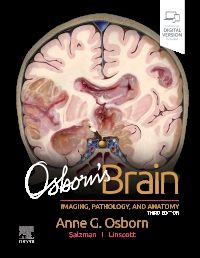 Osborn's Brain 3ed