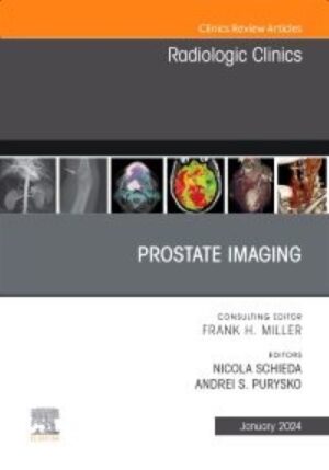 Prostate Imaging, An Issue of Radiologic Clinics