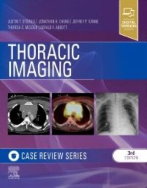 Stowell Thoracic Imaging