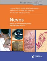 Cabrera Nevos, tumores neviformes y síndromes névicos