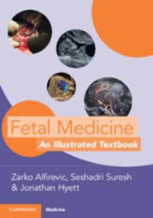 Alfirevic Fetal Medicine