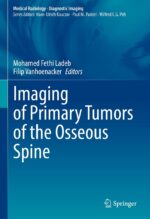 Fethi Imaging of Primary Tumors of the Osseous Spine