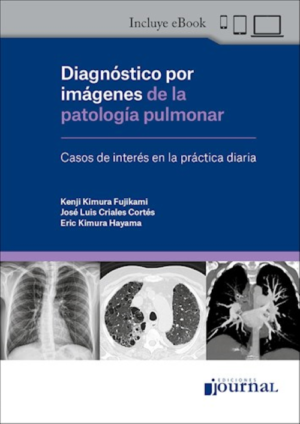 kimura Diagnóstico por imágenes de la patología pulmonar