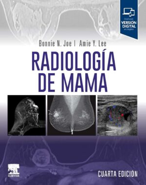 Radiología de Mama Joe