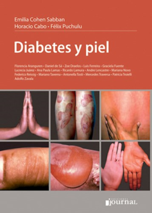 Cohen Diabetes y Piel