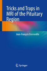 Bonneville Tricks and Traps in MRI of the Pituitary Region