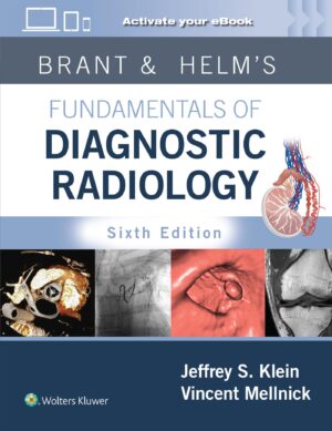 Brant & Helms' Fundamentals of Diagnostic Radiology