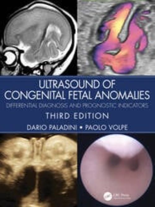 Paladini Ultrasound of Congenital Fetal Anomalies