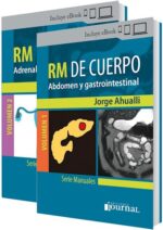 Ahualli RM de cuerpo