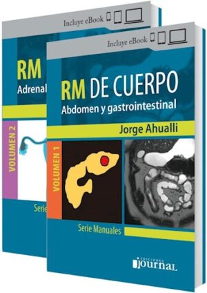 Ahualli RM de cuerpo