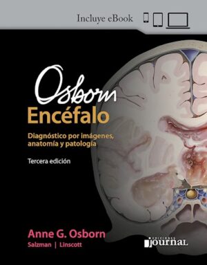 Osborn Encéfalo 3ed.